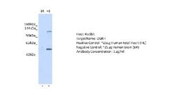 DGKH Antibody, Novus Biologicals 100 &mu;L; Unconjugated:Antibodies, Polyclonal